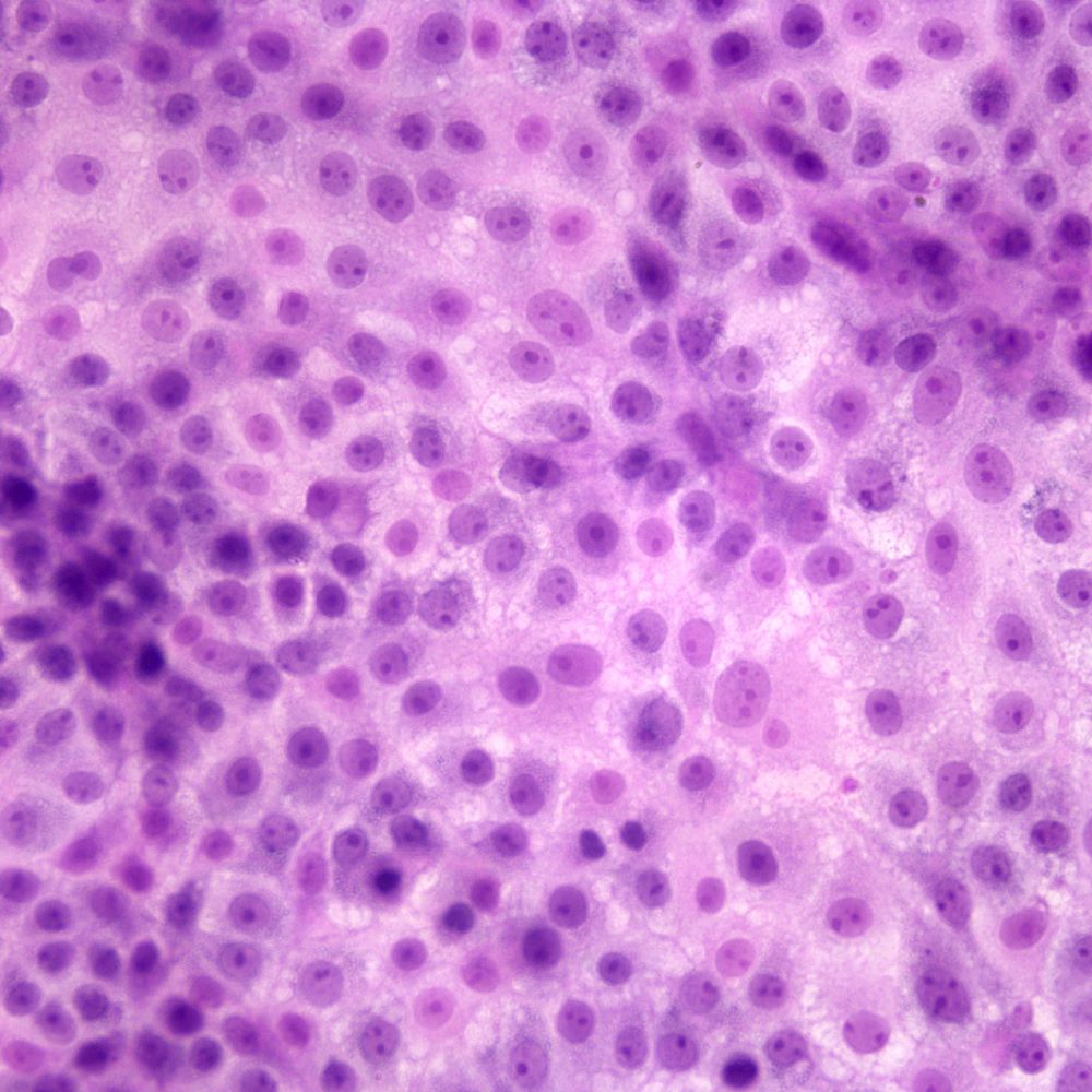 Hematoxylin and Eosin stained cells